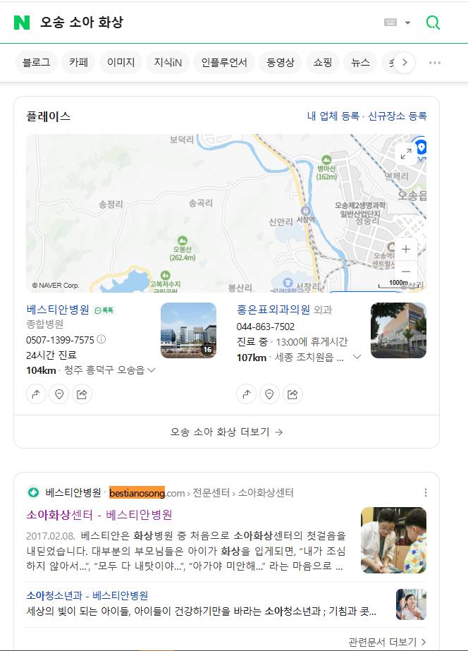 베스티안오송 — Naver에서 «오송 소아 화상» 검색 결과 캡처
