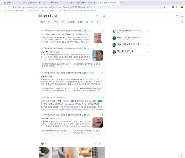 리트머스성형외과 — Naver에서 «삼성역 인중축소» 검색 결과 캡처