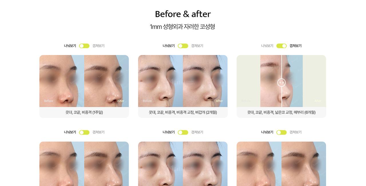 1mm 성형외과 홈페이지 화면