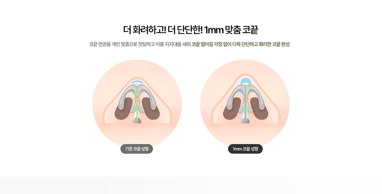 1mm 성형외과 홈페이지 화면