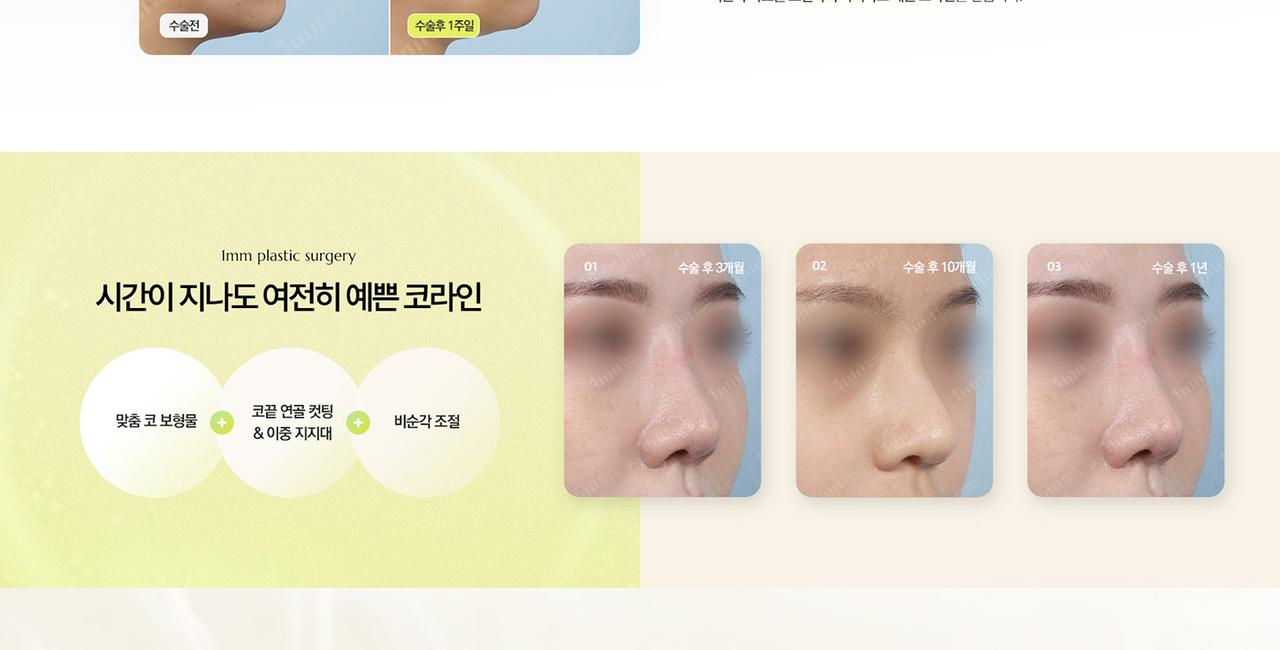 1mm 성형외과 홈페이지 화면