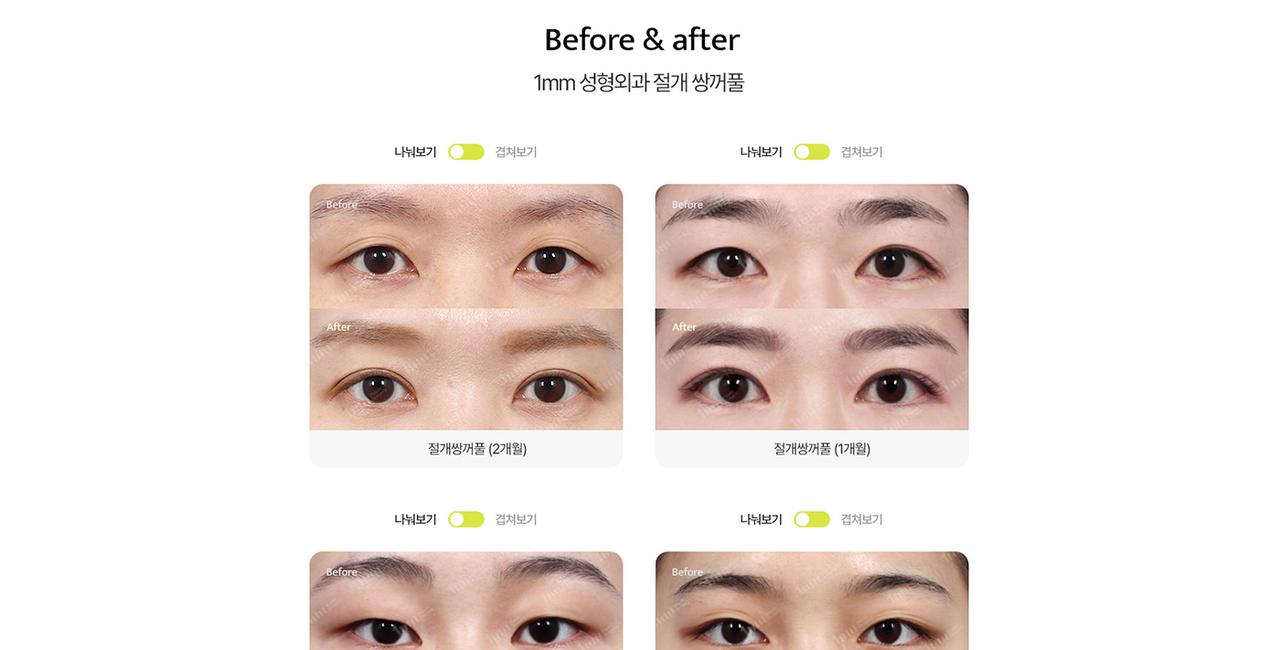1mm 성형외과 홈페이지 화면