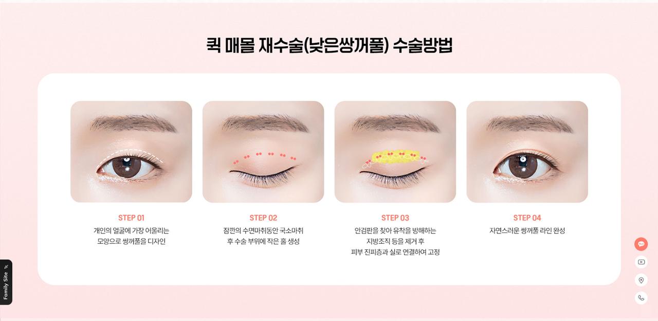 올리팅 성형외과 홈페이지 화면