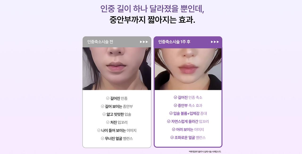 에이탑뷰티클리닉 홈페이지 화면