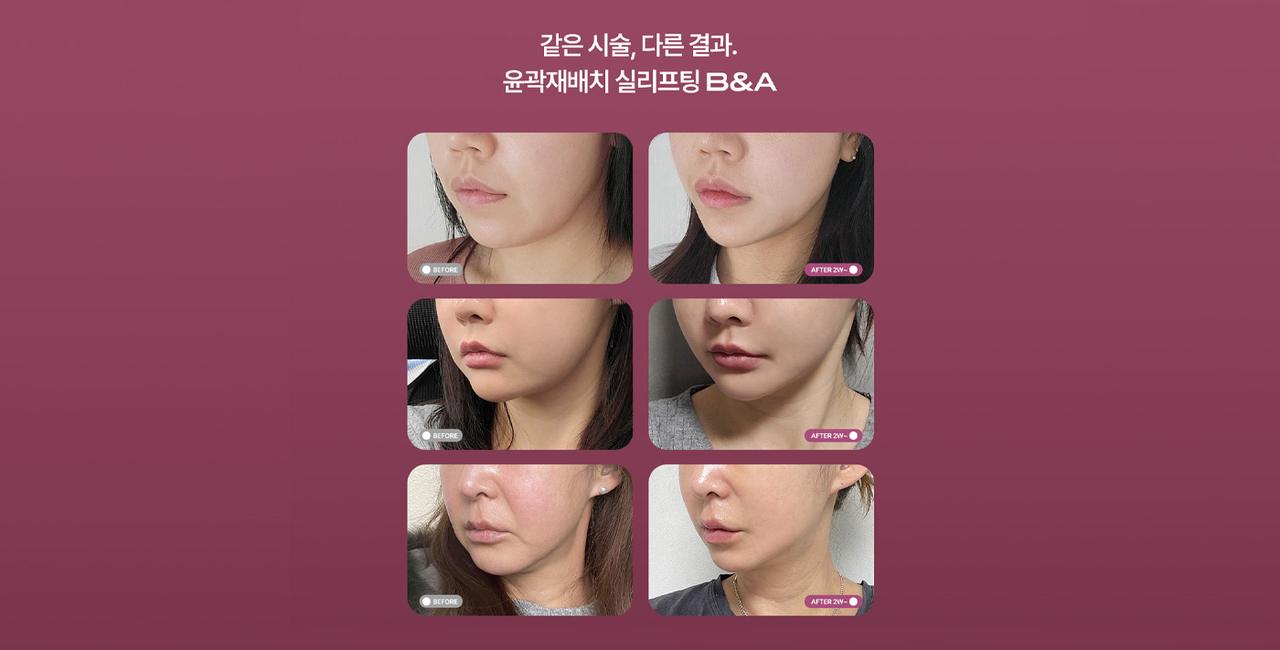 에이탑뷰티클리닉 홈페이지 화면