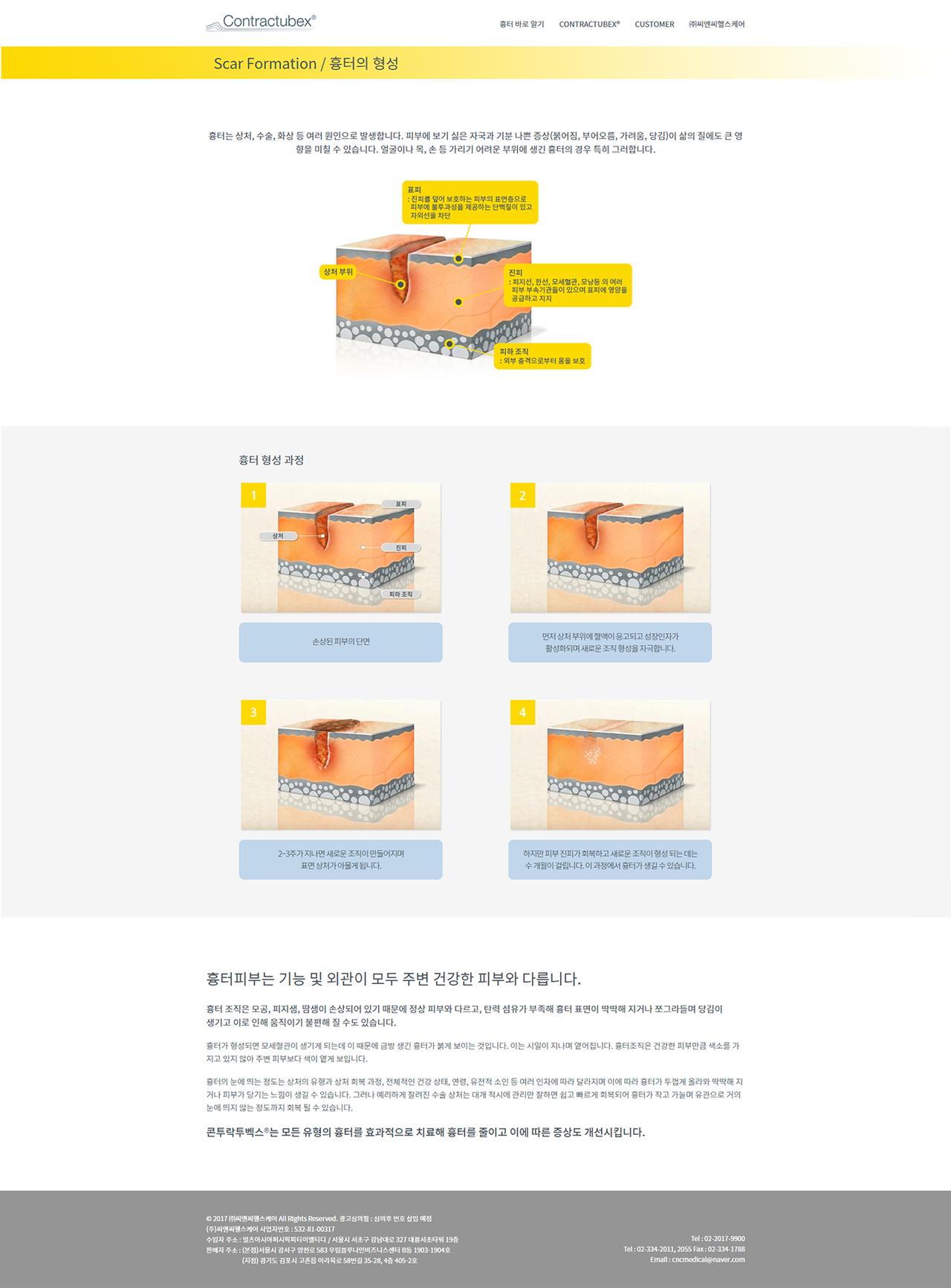 Contractubex 홈페이지 화면