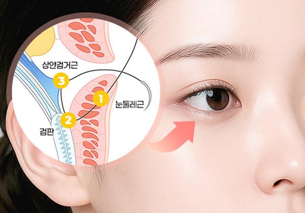 디유성형외과의원 홈페이지 화면