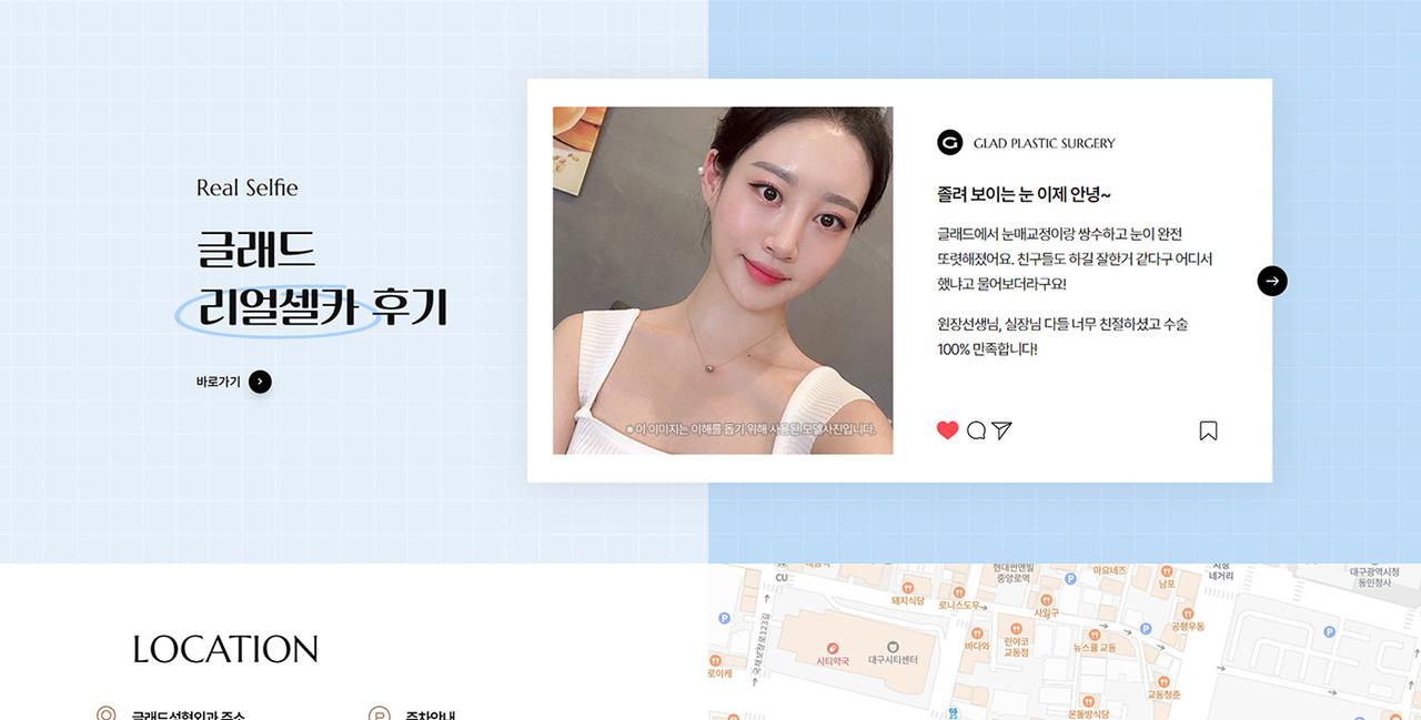 글래드 성형외과 홈페이지 화면