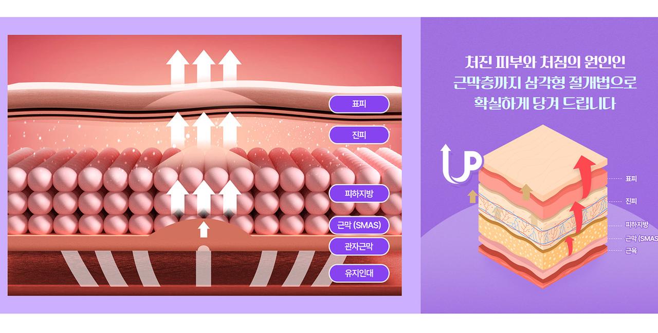 글래드 성형외과 홈페이지 화면