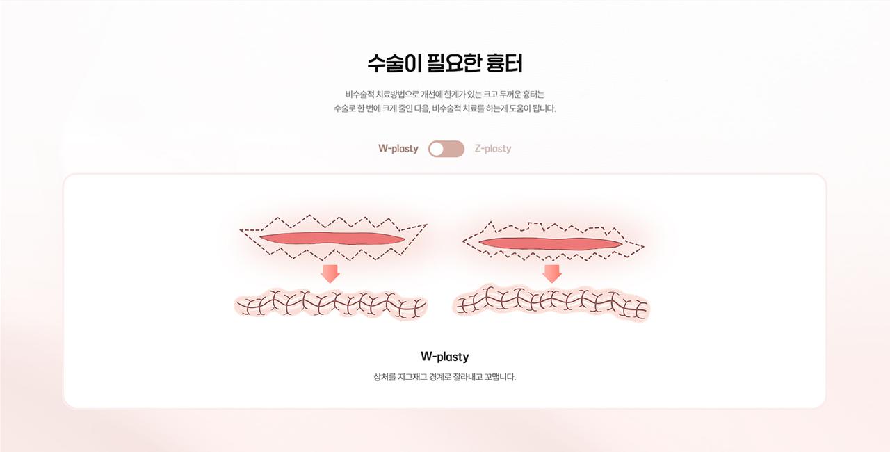송도리더스성형외과 홈페이지 화면