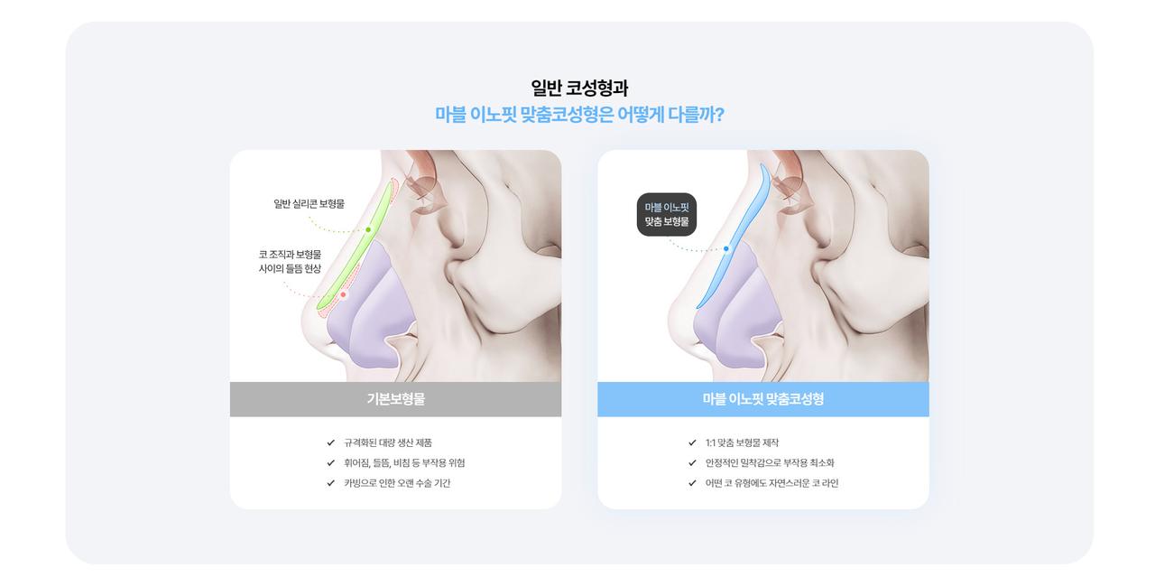 마블성형외과 홈페이지 화면