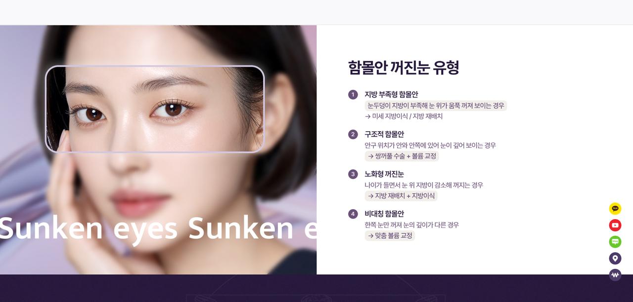 모마성형외과 홈페이지 화면