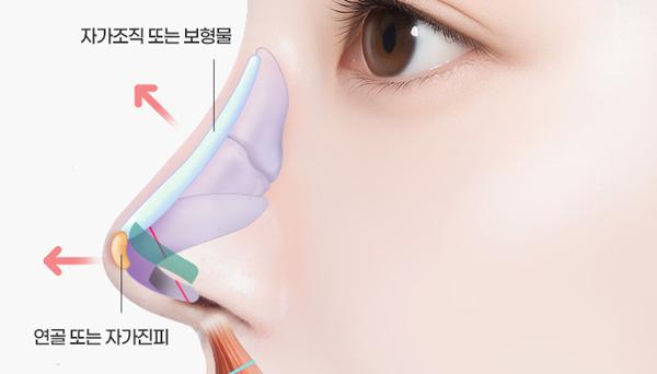 모마성형외과 홈페이지 화면