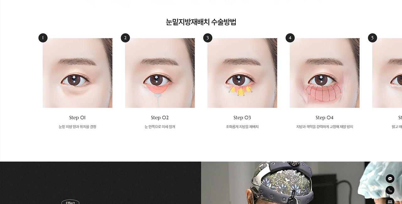 워나성형외과 홈페이지 화면