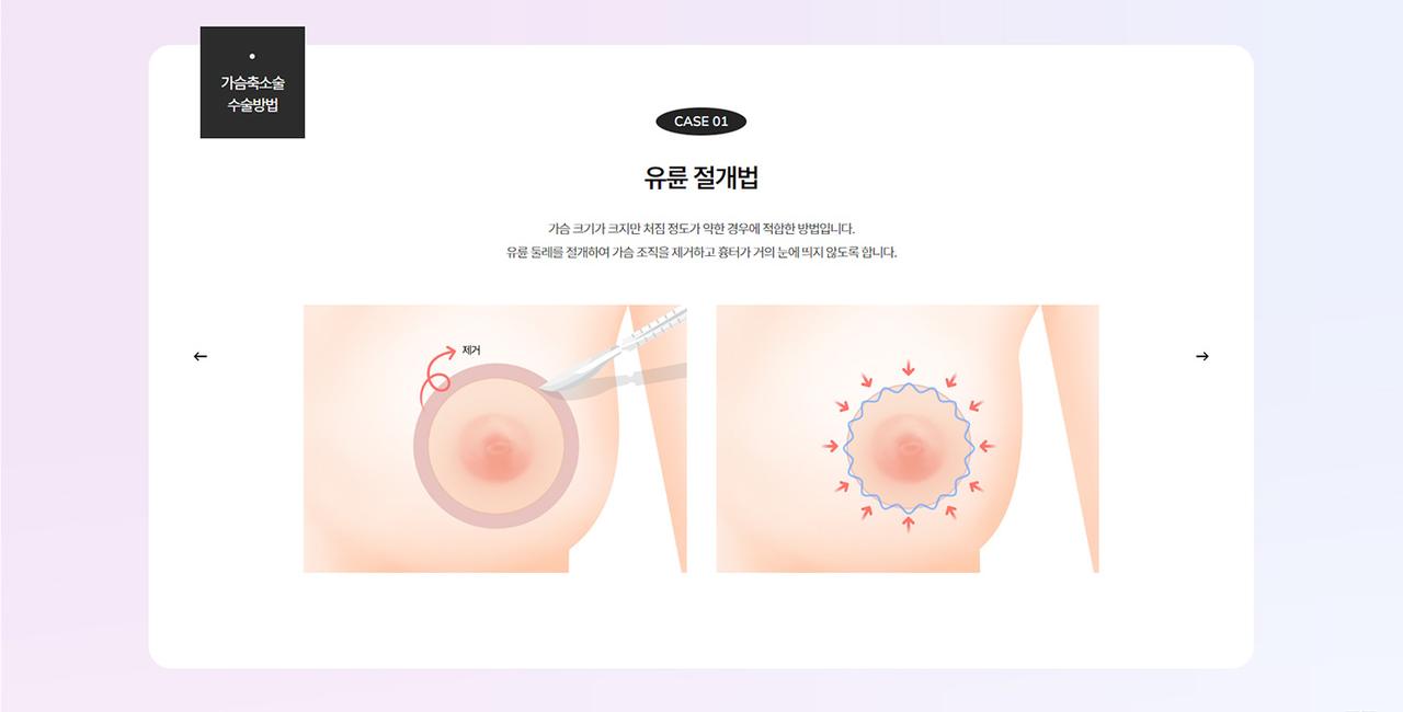 워나성형외과 홈페이지 화면