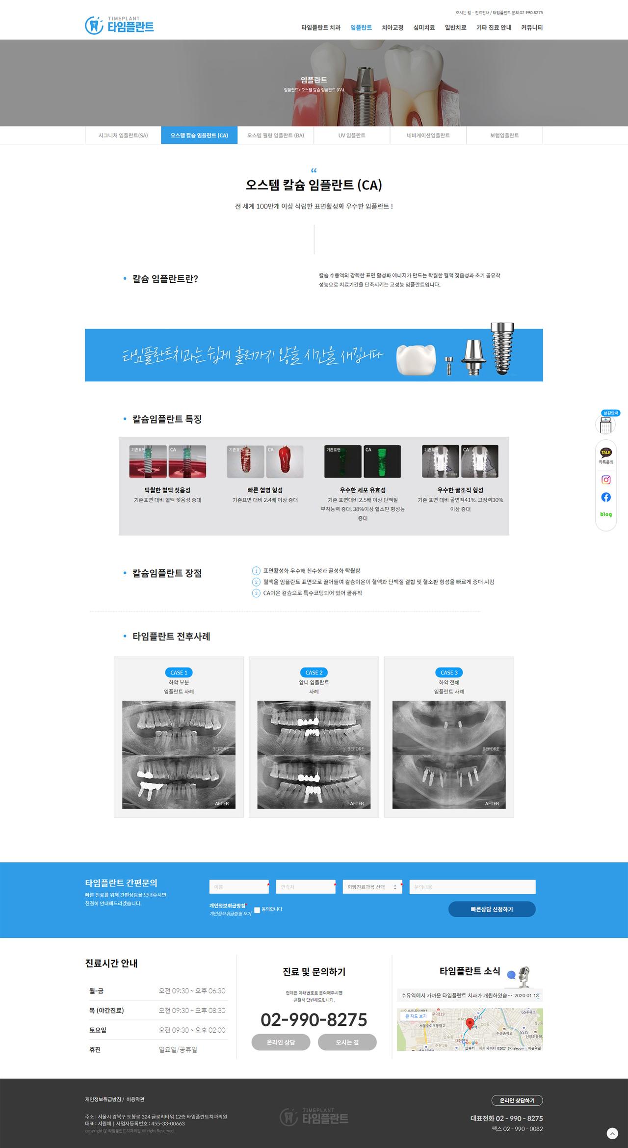 타임플란트치과 홈페이지 화면 (전체 페이지)
