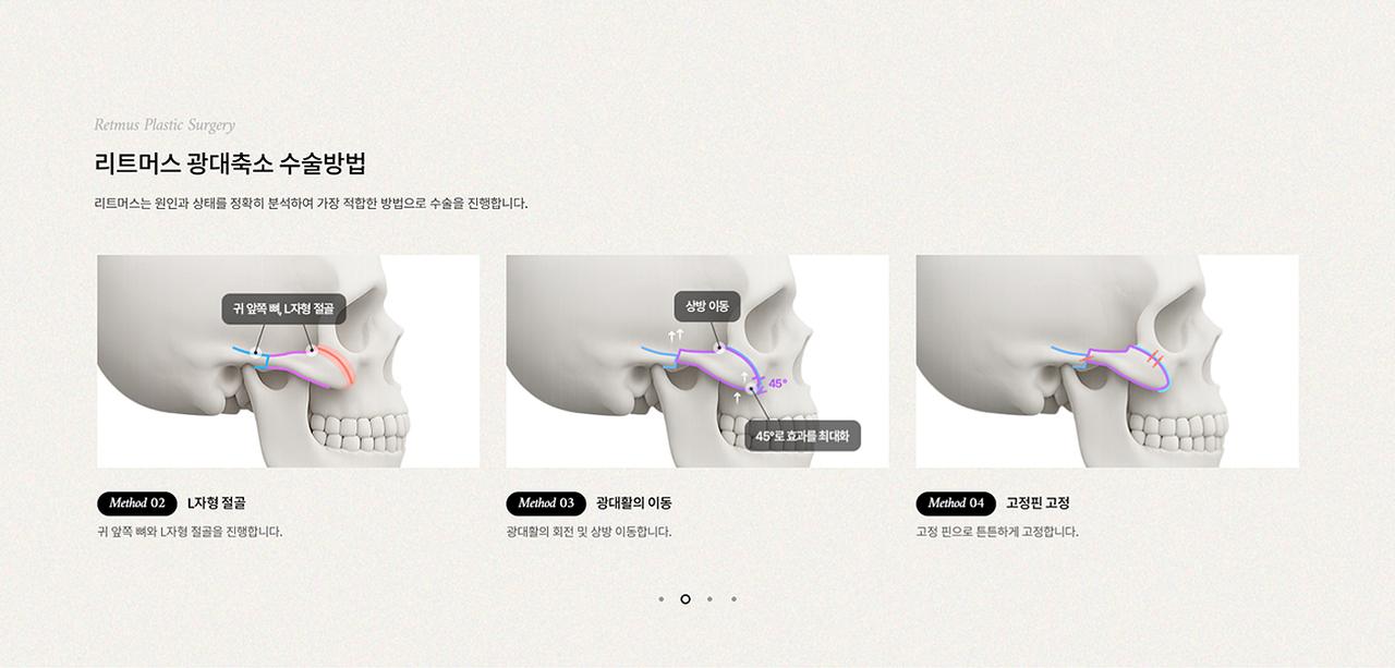 리트머스성형외과 홈페이지 화면