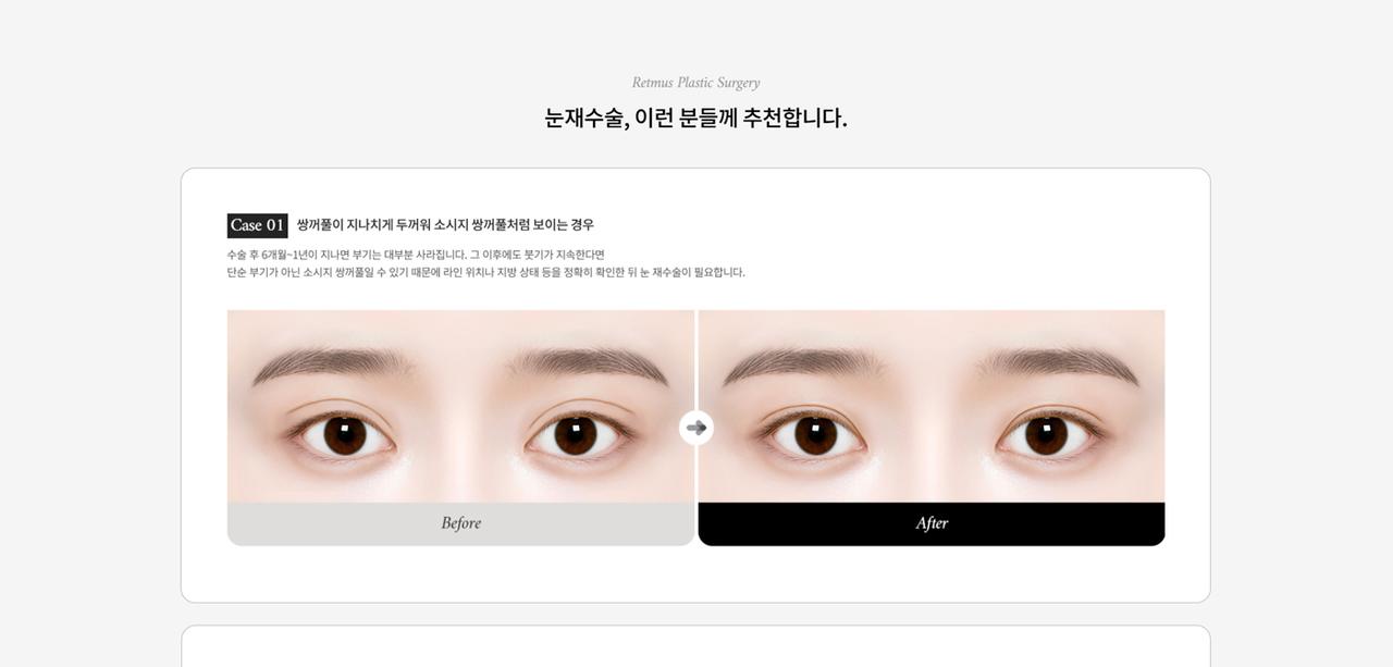 리트머스성형외과 홈페이지 화면