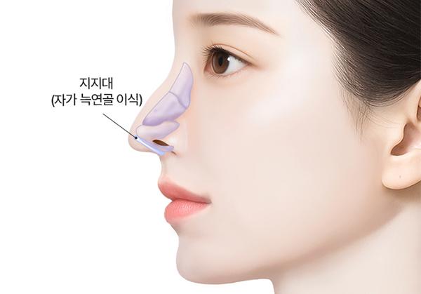 리트머스성형외과 홈페이지 화면