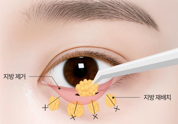 리트머스성형외과 홈페이지 화면