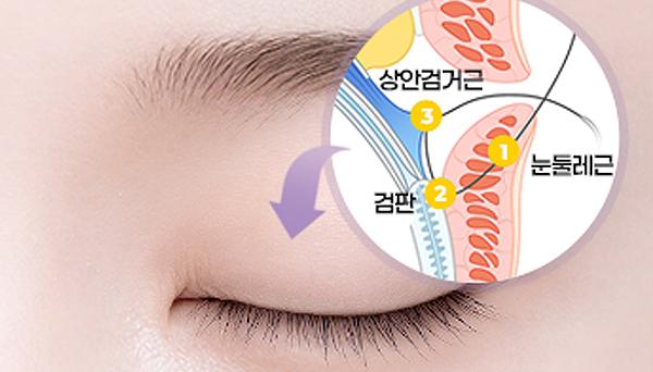 리네성형외과 홈페이지 화면