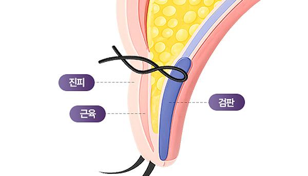 리네성형외과 홈페이지 화면