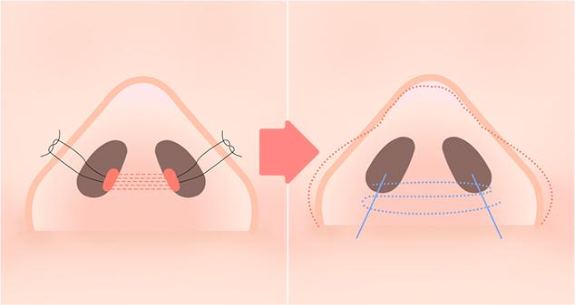 새김성형외과 홈페이지 화면