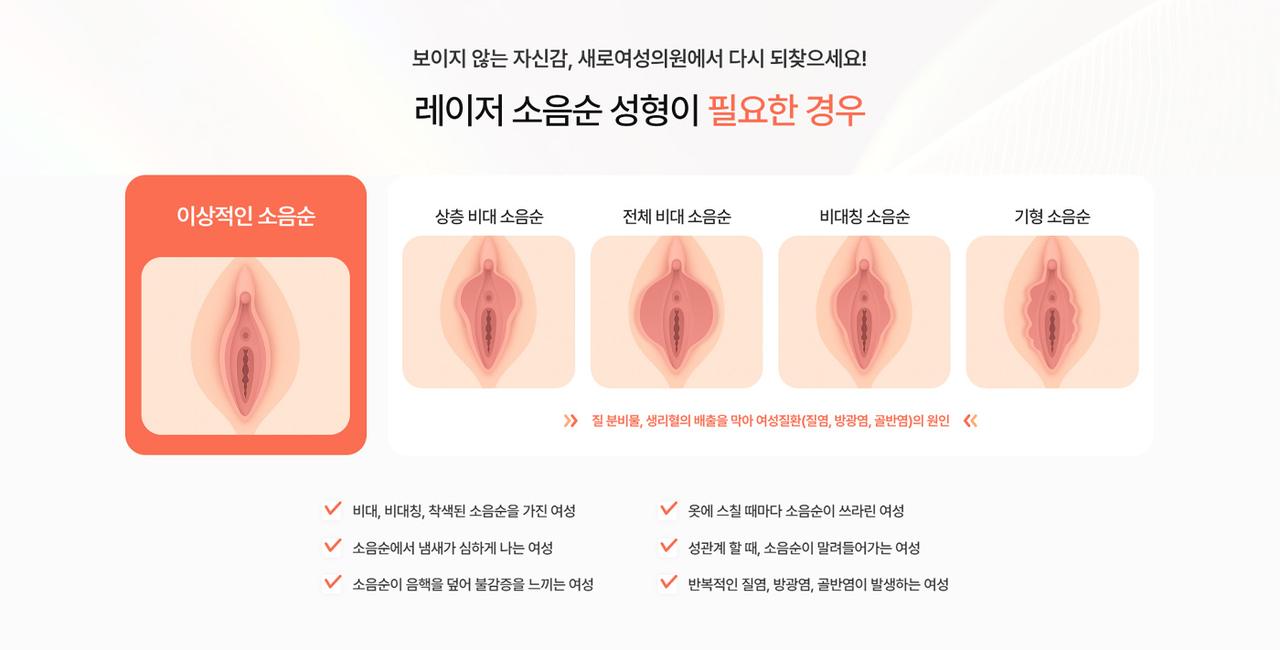 새로여성의원 홈페이지 화면