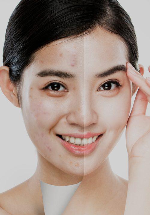 쏠라테라피 홈페이지 대표 이미지