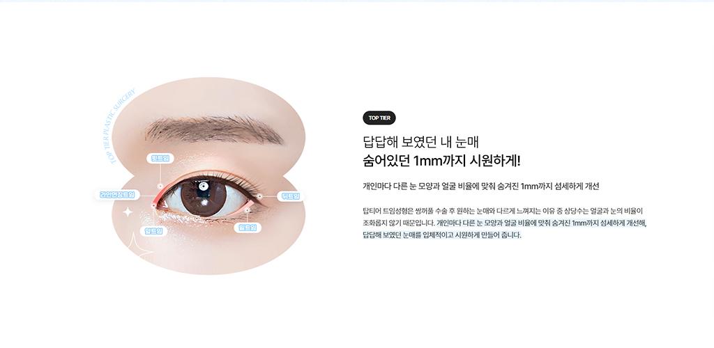 탑티어성형외과 홈페이지 화면