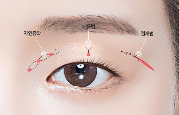 탑티어성형외과 홈페이지 화면