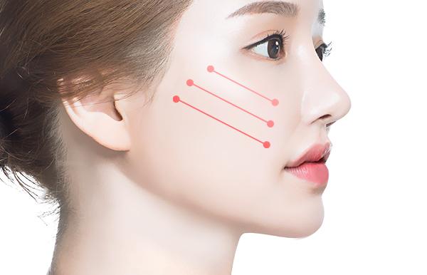탑티어성형외과 홈페이지 화면