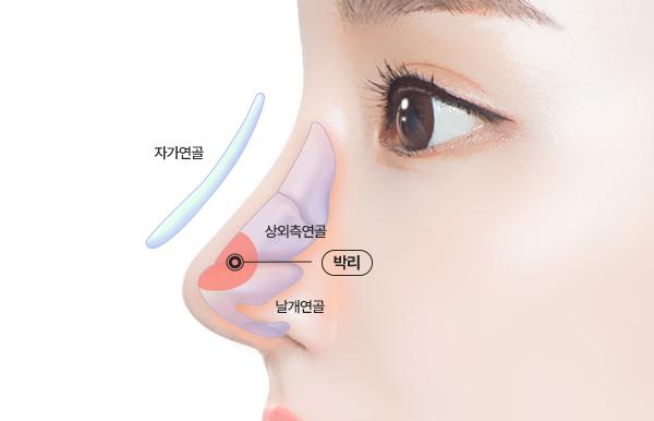 탑티어성형외과 홈페이지 화면