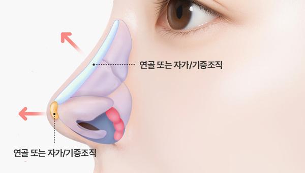 바이브성형외과 홈페이지 화면