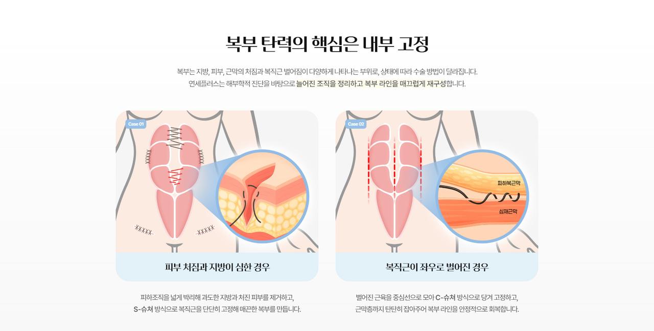 연세플러스의원 홈페이지 화면